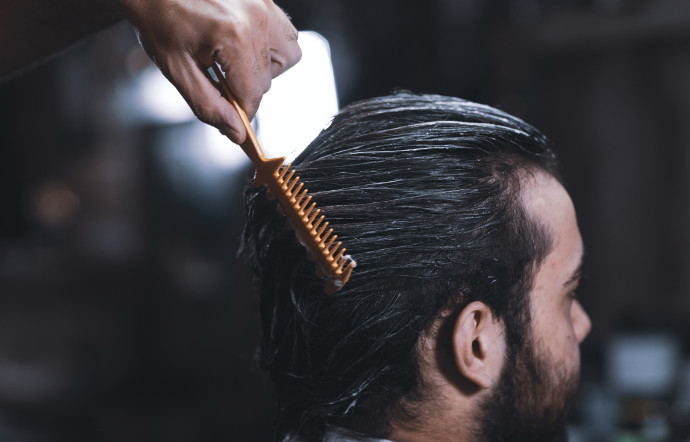 chute de cheveux les remèdes avant la greffe